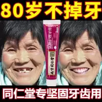 [专固齿用]牙缝宽修复牙齿松动牙根暴露牙龈萎缩牙龈炎特效牙膏 1盒体验装