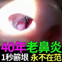 鼻炎膏过敏性鼻炎鼻塞鼻甲肥大鼻息肉克星鼻窦炎不通气祖传土方 一瓶体验装
