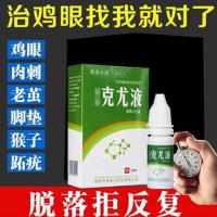 鸡眼专用猴子去跟老茧鸡眼膏去跟老茧猴子刺猴鸡眼膏贴磨砂膏液 一支体验装