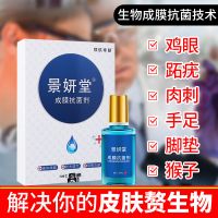 鸡眼膏非特效去除鸡眼猴子跖疣肉刺瘊脚底根死皮手部足部老茧 1盒装体验装