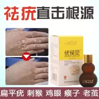 去除脖子小肉粒颈部赘皮赘草温和不留疤 祛丝状尤腋下小猴子 一盒装