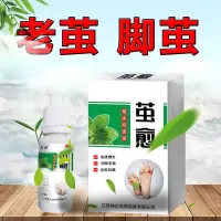 专业祛老茧死皮硬皮增厚去脚茧去角质手脚鸡眼陈年关节茧脚皮脚垫