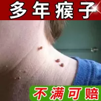 扁平尤疣去除脖子小肉粒草本温和不留疤腋下小猴子丝状皮赘