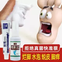 7天去脚气 ]去脚气喷剂除脚气膏脚痒水泡脚臭蜕皮烂脚丫脚汗 单瓶喷脚王喷剂