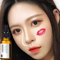 买2发3增高鼻梁瘦鼻学生挺鼻翘鼻隆鼻美鼻神器缩小鼻翼瘦鼻头精油 阿琪思鼻部精油