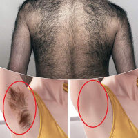 脱毛膏去脱腋下腿毛私处阴毛唇毛脸部男女专用学生全身绝液不永久 一瓶60g