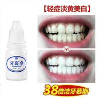 [一擦白十年]牙齿美白神器去黄牙结石黑牙烟渍茶渍洗牙粉牙斑净 [38倍功效]轻度牙黄
