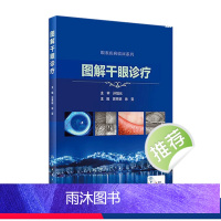 [正版]图解干眼诊疗 晋秀明徐雯主编 眼科学干眼症治疗干眼检查诊疗护理睑缘炎结膜角膜病变人民卫生出版社眼科书籍