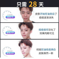 男士护肤品套装洗面奶保湿补水乳专用控油祛痘夏季洗护三件套礼盒