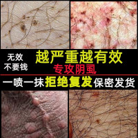 皇阴虱友三号益其体虱康7琪时除头虱私处虱跳骚克星严头发灵七号