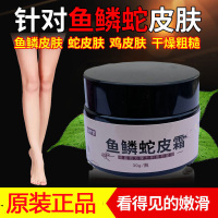 鸡皮肤去鱼鳞蛇皮肤干燥起皮脱皮全身体软膏乳膏买1送1