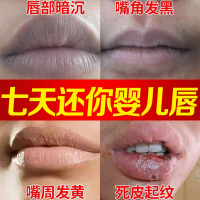 30ml 嘴角黑色素去除嘴唇周围暗沉发黑唇周唇嘴边唇膜去黑唇色淡化死皮