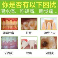 博士35ml/孕妇小孩大人通用型 孕妇牙疼牙痛宁炎消固齿速效防止蛀虫止疼牙痛立可停牙龈上火肿痛