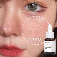 #杏仁酸刷酸#* 水杨酸精华液去黑头控油除螨祛痘深层清洁学生党补水保湿杏仁酸