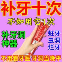 填补蛀牙牙洞修复龋齿黑斑防蛀牙齿松动补牙洞的东西填牙洞牙膏 填补蛀牙牙洞修复龋齿黑斑防蛀牙齿松动补牙洞的东西填牙洞牙膏