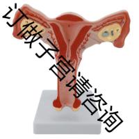 500个以上订做子宫 医学女性子宫模型卵巢生殖结构解剖模型妇科妇产科卵巢子宫模型