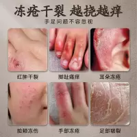 1盒[30g]体验 北京防冻皲裂修护膏手脚护手霜防裂脚裂开裂官方旗舰店