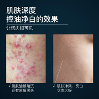 男士氨基酸洗面奶清洁深海泥控油去痘早晚套装日夜两用专用洁面乳