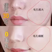 33片 蜗牛原液面膜补水保湿收缩毛孔粗大修复缩小紧细致嫩白女男士专用