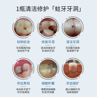 儿童洗牙粉蛀牙修复牙洞龋齿清理牙膏去虫牙菌斑祛除神器牙齿黑斑