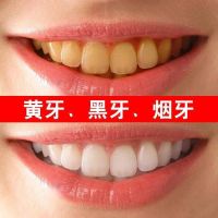 妙秒树记牙粉益炫白贝净牙粉芳方馨素锦景正堂净牙素莱来町宁洁牙