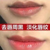 去嘴唇部去唇周边黑暗沉唇膜去黑色素嘴边学生嘴巴角唇纹精华护理 去嘴唇部去唇周边黑暗沉唇膜去黑色素嘴边学生嘴巴角唇纹精华护