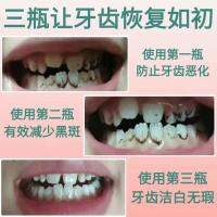 一瓶装(1%妈妈的选择) 益生菌儿童3-15岁防蛀牙膏龋齿修复不含氟可吞咽牙齿松动虫洞清理