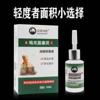 轻度(建议一元面积大小的) 去脚底老茧死皮软化剂祛脚趾头上手足部关节茧去除脚垫脚茧子神器