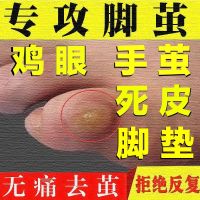 一盒体验装[药量少] 去脚底老茧死皮软化剂祛脚趾头上手足部关节茧去除脚垫脚茧子神器