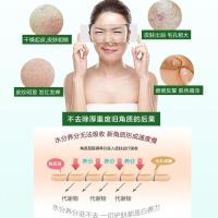 去角质素凝胶男女慕斯啫喱脸部面部祛死皮黑头全身磨砂膏清洁毛孔