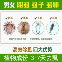 百部酊50%阴虱立虱疥一扫光通济克虱堂友皇3号清虱净泽章赣灵三号