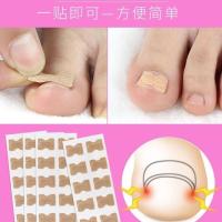 正甲胶条贴防卷甲免胶水脚趾嵌甲矫正器甲贴片修指甲专用一贴即可 一板[10贴]