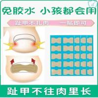 正甲贴甲沟嵌甲矫正器脚趾甲纠正指甲贴片长肉里修正甲神器拉拉炎 免胶水10贴