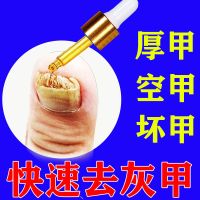 [蓓美琳去灰甲]修复灰甲去除厚甲空甲甲变色软甲膏滋养亮甲 [去坏甲厚甲空甲 [灰指甲1瓶]使用15天的量