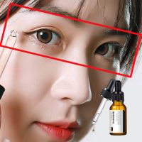 2送1扩眼阔眼精油大眼睛单眼皮扩眼角眼皮松弛双眼皮去浮肿精华