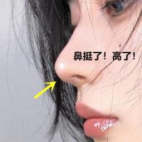 精油按摩鼻子增高器缩小鼻翼变挺高鼻梁变小美鼻瘦鼻学生女 一瓶体验装