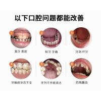 儿童防蛀牙修复牙洞龋齿牙膏清理牙菌斑祛除神器去虫牙洗牙粉黑斑