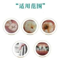 N74-自定义 50g 防治蛀牙龋齿修复牙膏虫牙洞牙齿黑斑清理神器牙疼去除黑牙粉