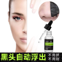 拍1送1发2支 去黑头导出液10ml 精华液 软化T区角质收缩毛孔去吸黑头