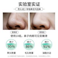 黑头贴10片装 去黑头鼻贴粉刺收缩毛孔吸黑头导出液控油黑头贴司普倒丽肽