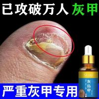 [专攻灰指甲]特效液增厚灰甲亮甲去除灰指甲专用脱甲油抑菌液 无/效/包/陪 一瓶装[刚发现者]