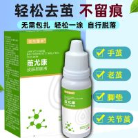 去鸡眼老茧膏老茧子手死皮足部脚掌脚垫硬皮软化膏无痛去鸡眼贴 一盒装 [试用装]