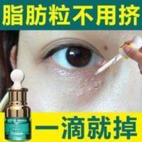 [48小时发货]去除脂肪粒黑眼圈扁平尤男女神器汗管溜抗皱保湿眼膏眼角纹精华素 去除脂肪粒黑眼圈扁平尤男女神器汗管溜抗皱保