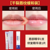 [缓和干裂唇纹]唇部精华+精华 唇膏唇部精华去嘴周边黑保湿滋润补水皮淡化唇纹唇乳润唇膏