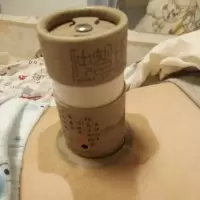 桶3个艾柱1盒胶布2袋# 百岁灸圣笑灸凤灸小筒灸艾灸盒罐艾灸装置灸乐艾灸筒家用艾灸套盒