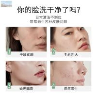 J63-T30-墨角藻泥膜棒1支 植之璨泥膜棒深层清洁黑头粉刺补水保湿清爽控油敏感肌缩小毛孔理