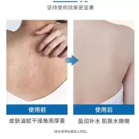 sakose凡士林身体乳保湿滋润夏季果酸润肤精华改善肌肤补水500ml