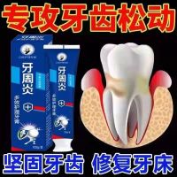 [牙松不用拔]牙齿松动修复牙龈萎缩牙周护理固齿牙周炎特效牙膏 2支装(牙周炎)