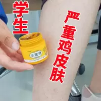 [治鸡皮肤神器]去毛囊角质去腿上鸡皮疙瘩鱼鳞蛇皮肤全身鸡皮 1瓶丿