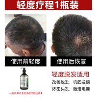 南京同仁堂防脱发洗发水生发密发育发洗发露控油生姜提取物洗发水 [药房同款]1支300ML